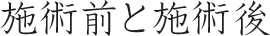 施術前と施術後